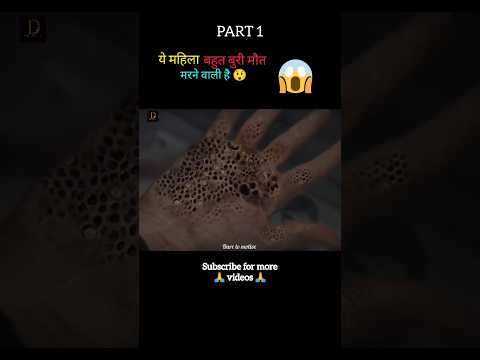 Trypophobia full movie explain in Hindi/Urdu part 1 😱 #shorts